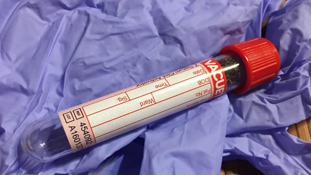 Adiós a las molestias biopsias